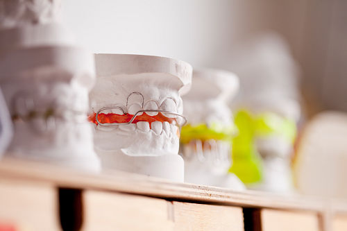 Symbolbild Kieferorthopädie